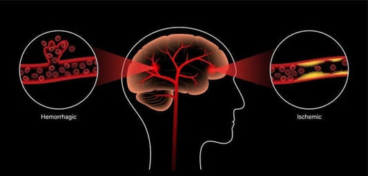 Voordelen van Roodlichttherapie voor de Hersenen: Gids 2025 voor Cognitieve Gezondheid - Mvolo